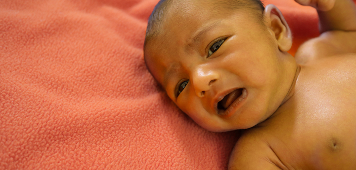 Young baby lying on their back on a blanket with jaundice yellow coloured skin, looking in pain.