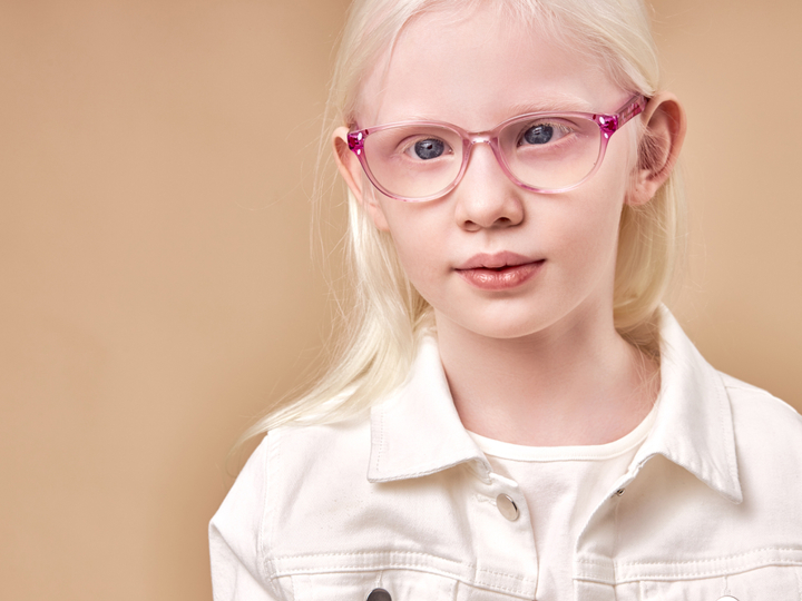 Girl with albinism wearing pink glasses.