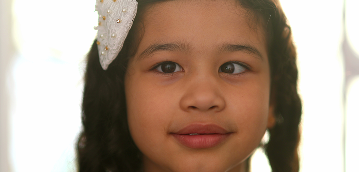 Girl With Squint